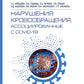 Нарушения кровообращения, ассоциированные с COVID-19: руководство для врачей