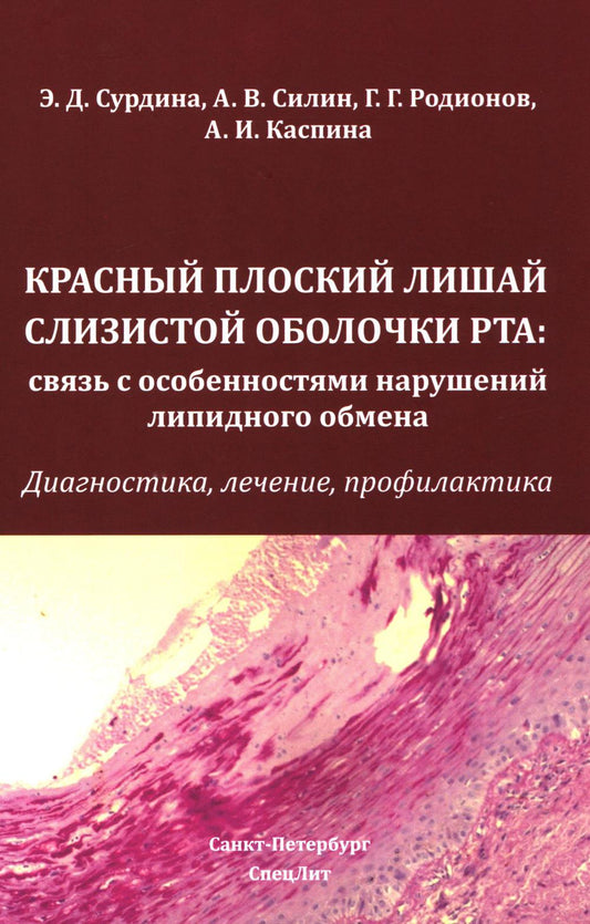 Красный плоский лишай слизистой оболочки рта: связь с особенностями нарушений липидного обмена. Диагностика, лечение, профилактика