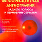 Флюоресцентная ангиография заднего полюса и периферии сетчатки: практическое руководство