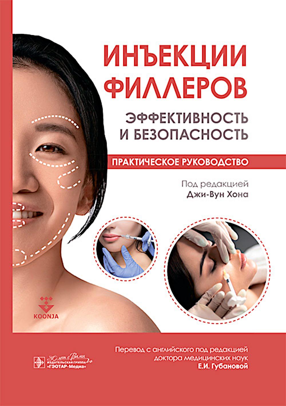 Injecteurs de remplissage. Efficacité et efficacité