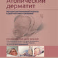 Атопический дерматит. Междисциплинарный подход к диагностике и лечению: руководство для врачей