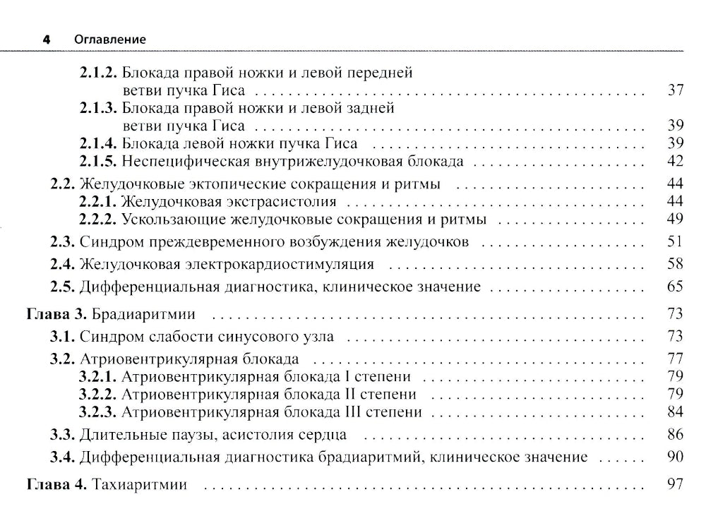 Électrocardiogramme : diagnostics différentiels précis. 2-e jour