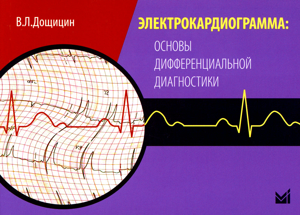 Électrocardiogramme : diagnostics différentiels précis. 2-e jour