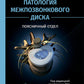 Патология межпозвонкового диска. Поясничный отдел