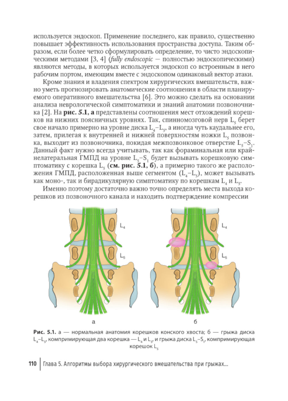 Патология межпозвонкового диска. Поясничный отдел