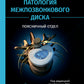 Патология межпозвонкового диска. Поясничный отдел