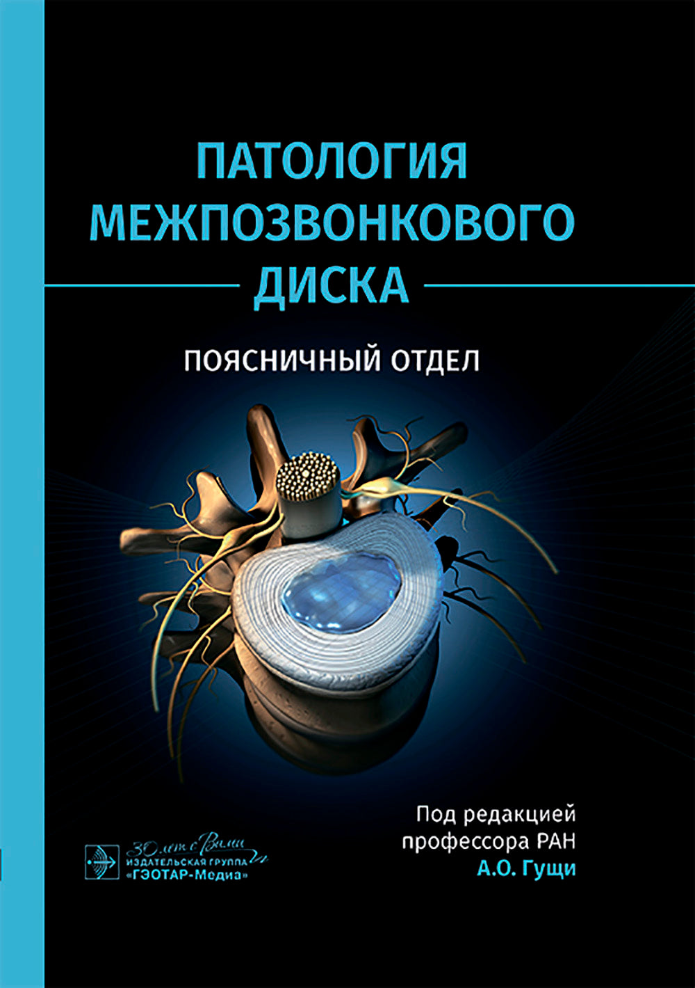 Патология межпозвонкового диска. Поясничный отдел
