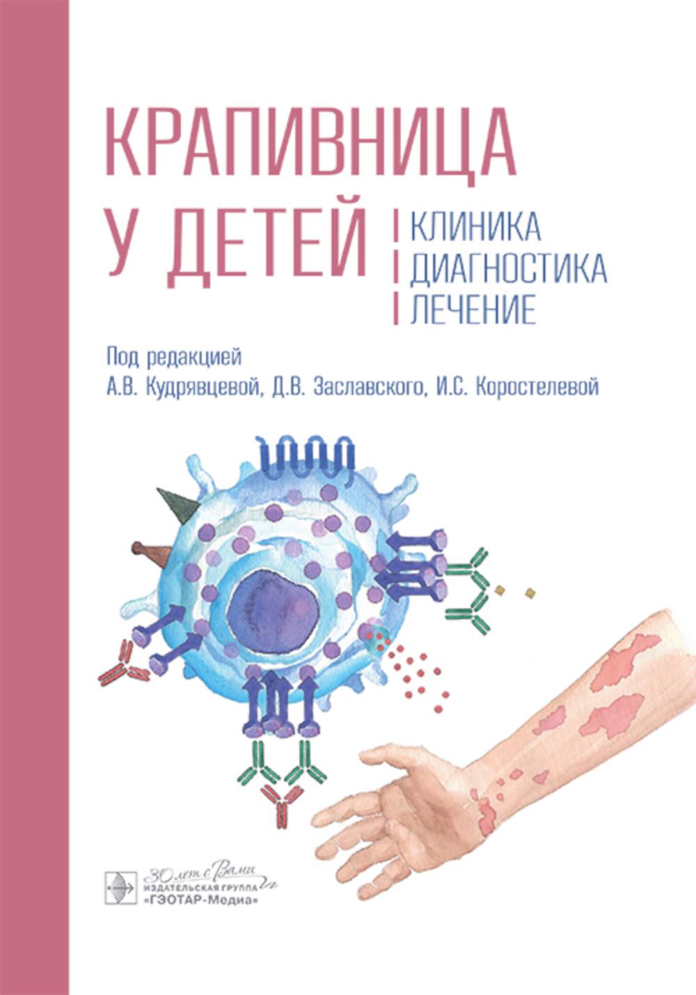 Крапивница у детей: клиника, диагностика, лечение