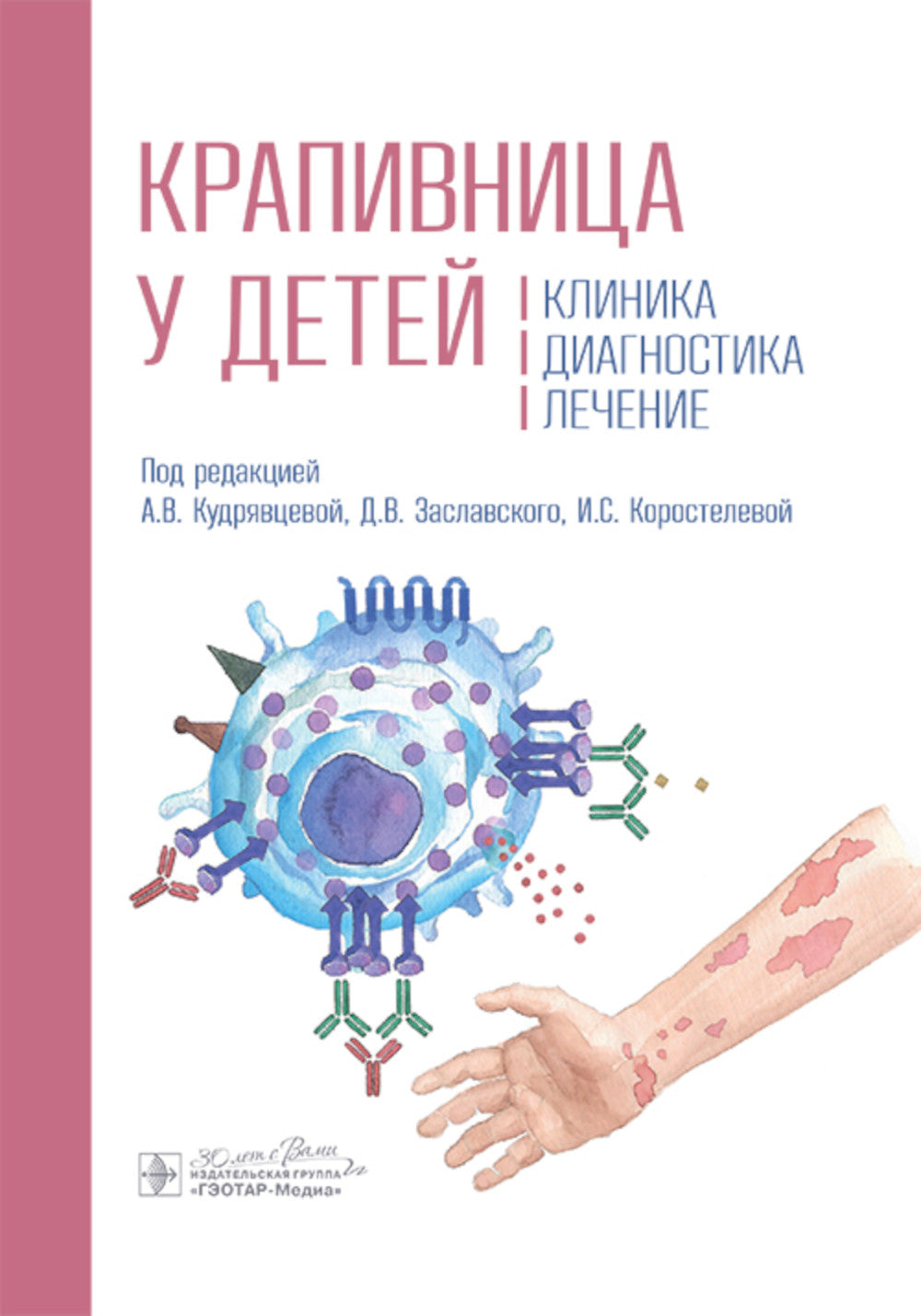 Крапивница у детей: клиника, диагностика, лечение