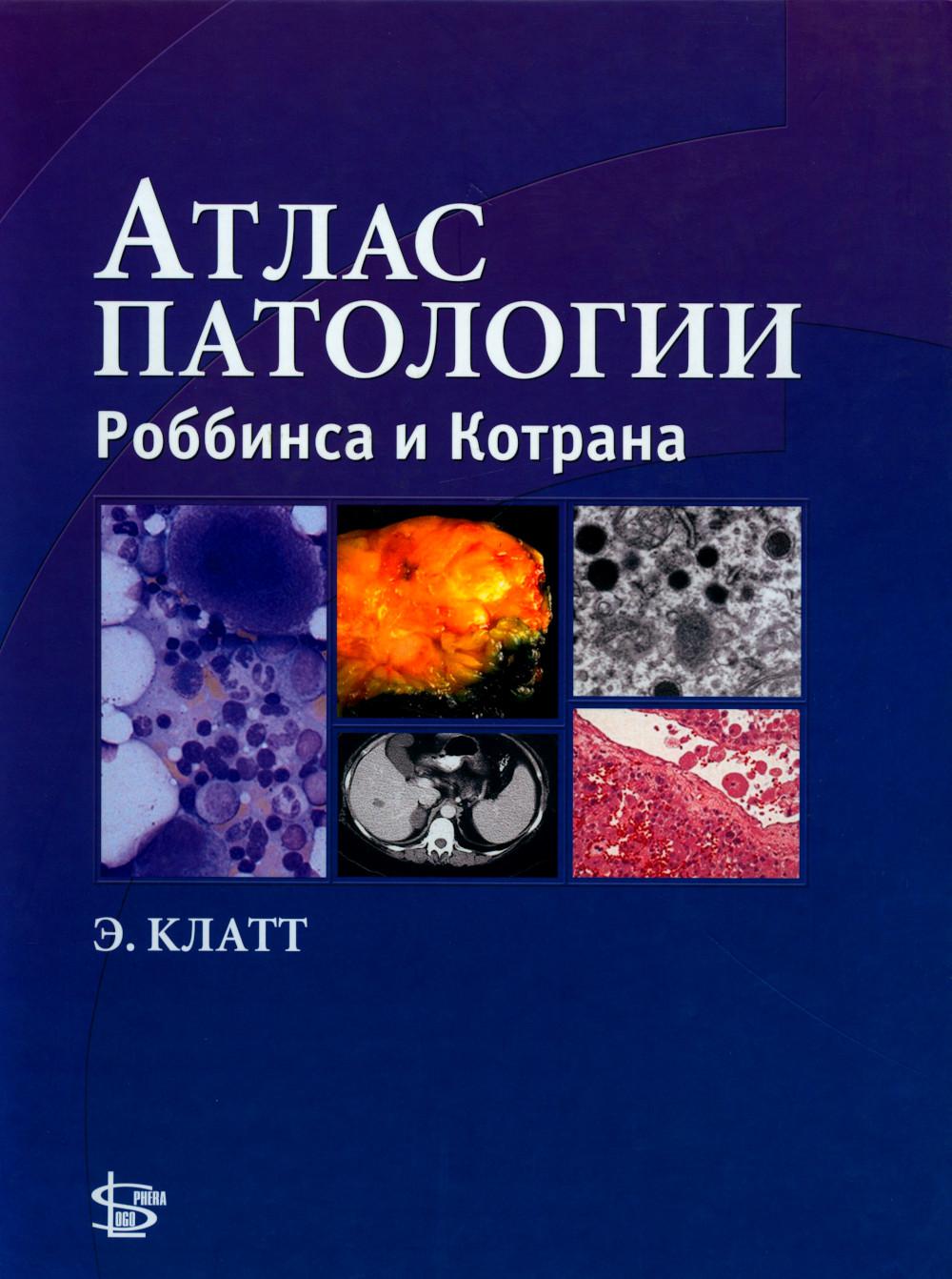 Атлас происхождения Роббинса и Котрана