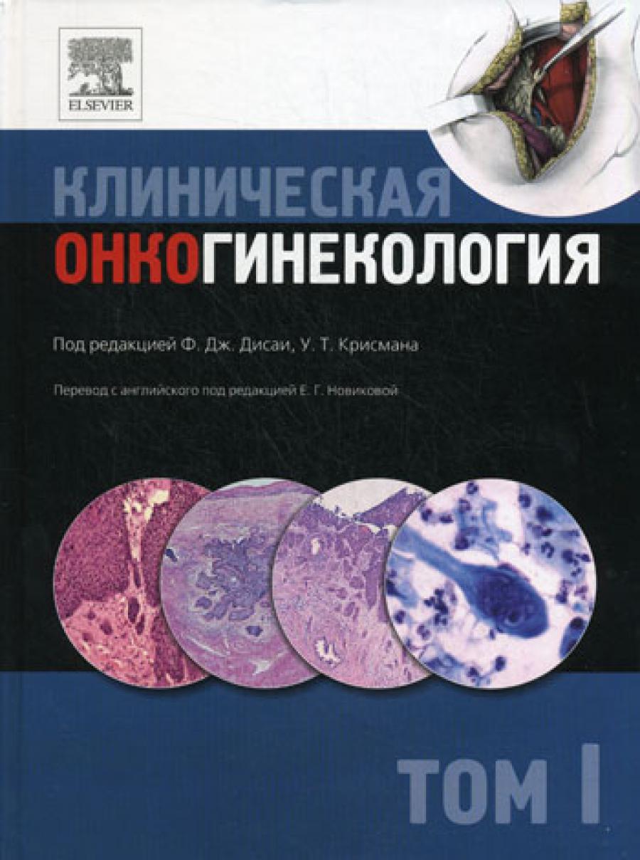 Клиническая онкогинекология. В 3 т. Т. 1