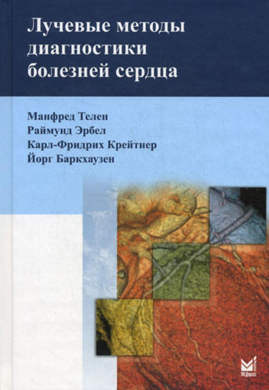 Лучевые методы диагностики заболеваний сердца
