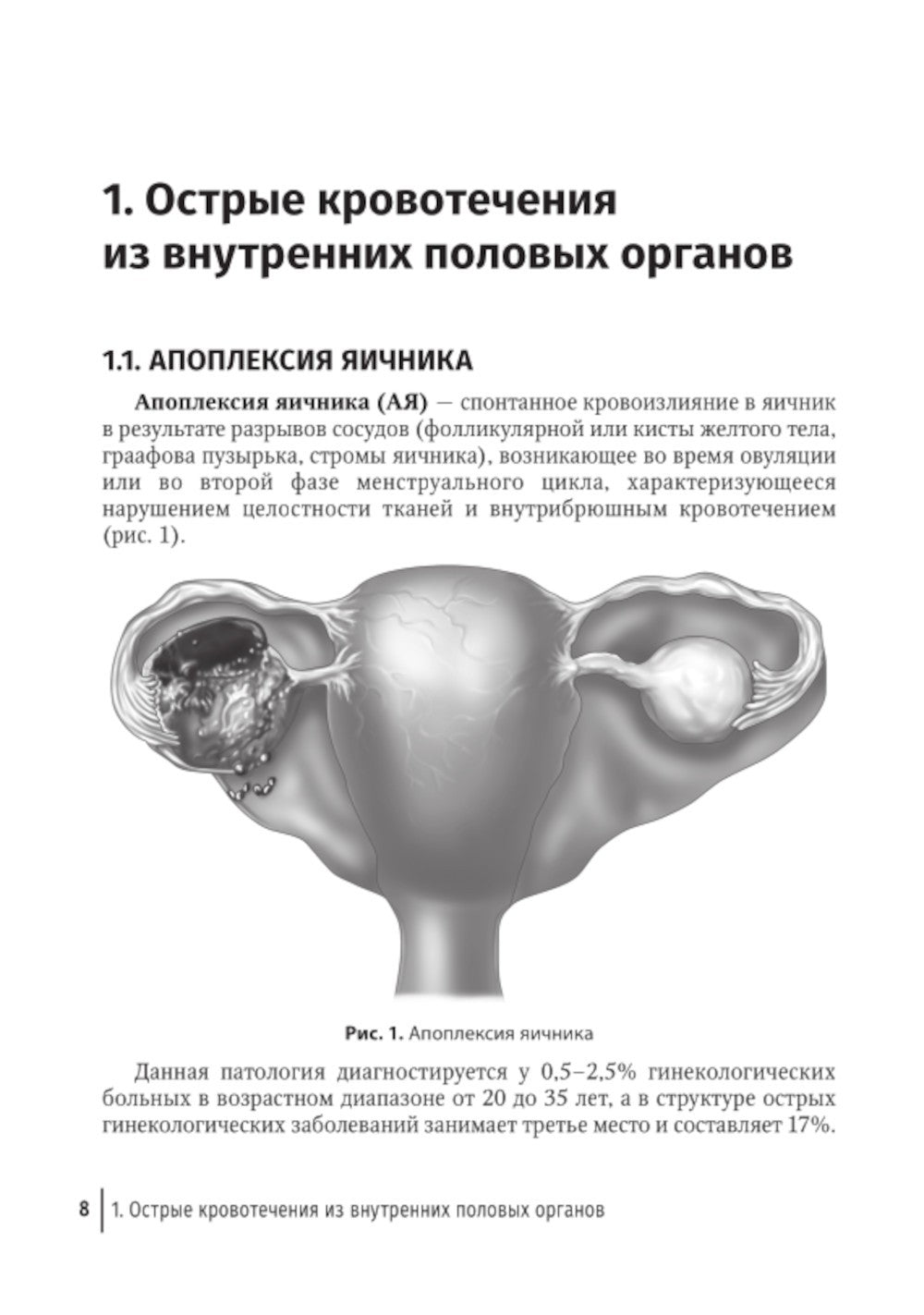Острый живот в гинекологии: руководство для врачей