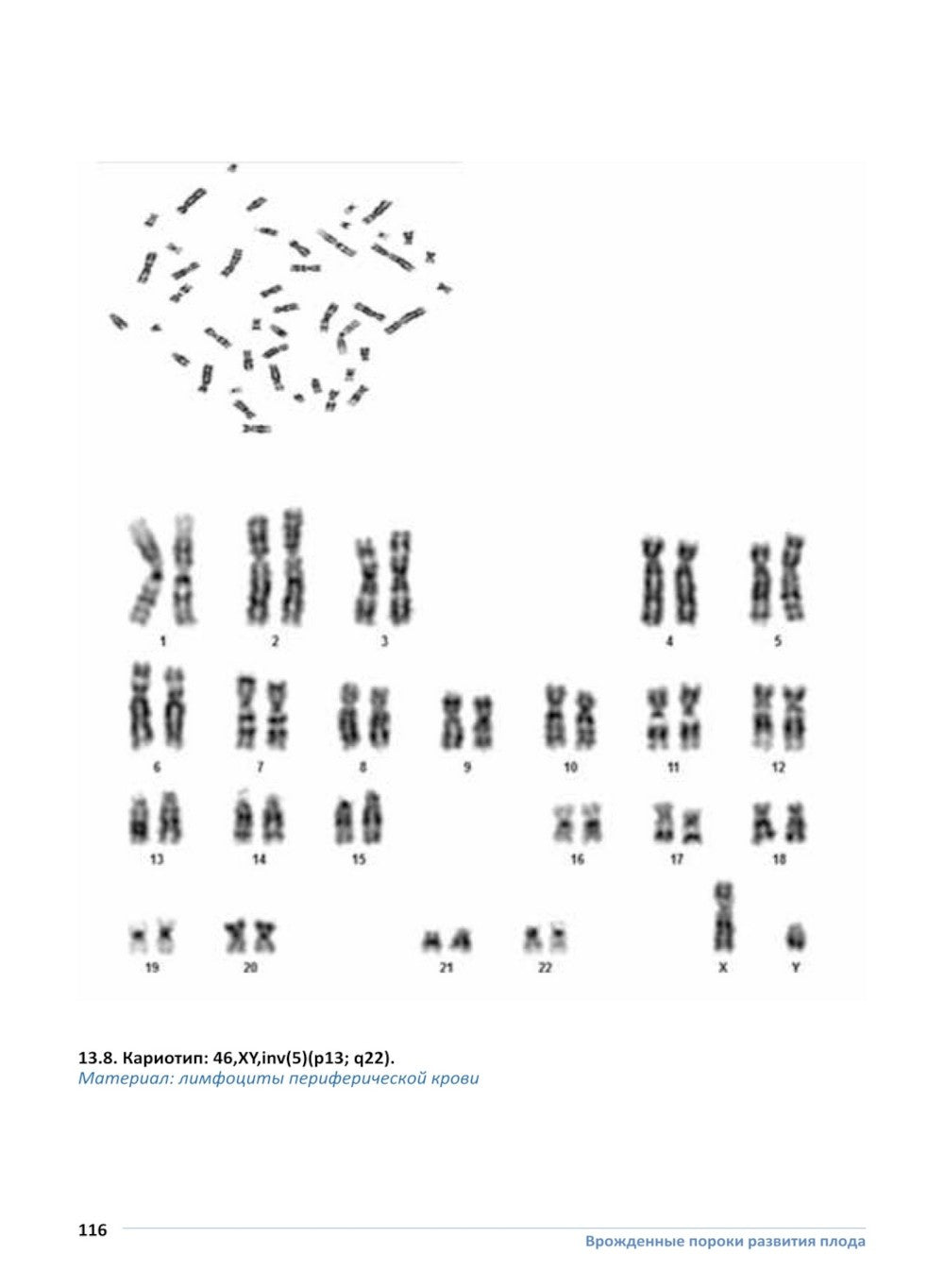 Врожденные пороки развития плода: атлас