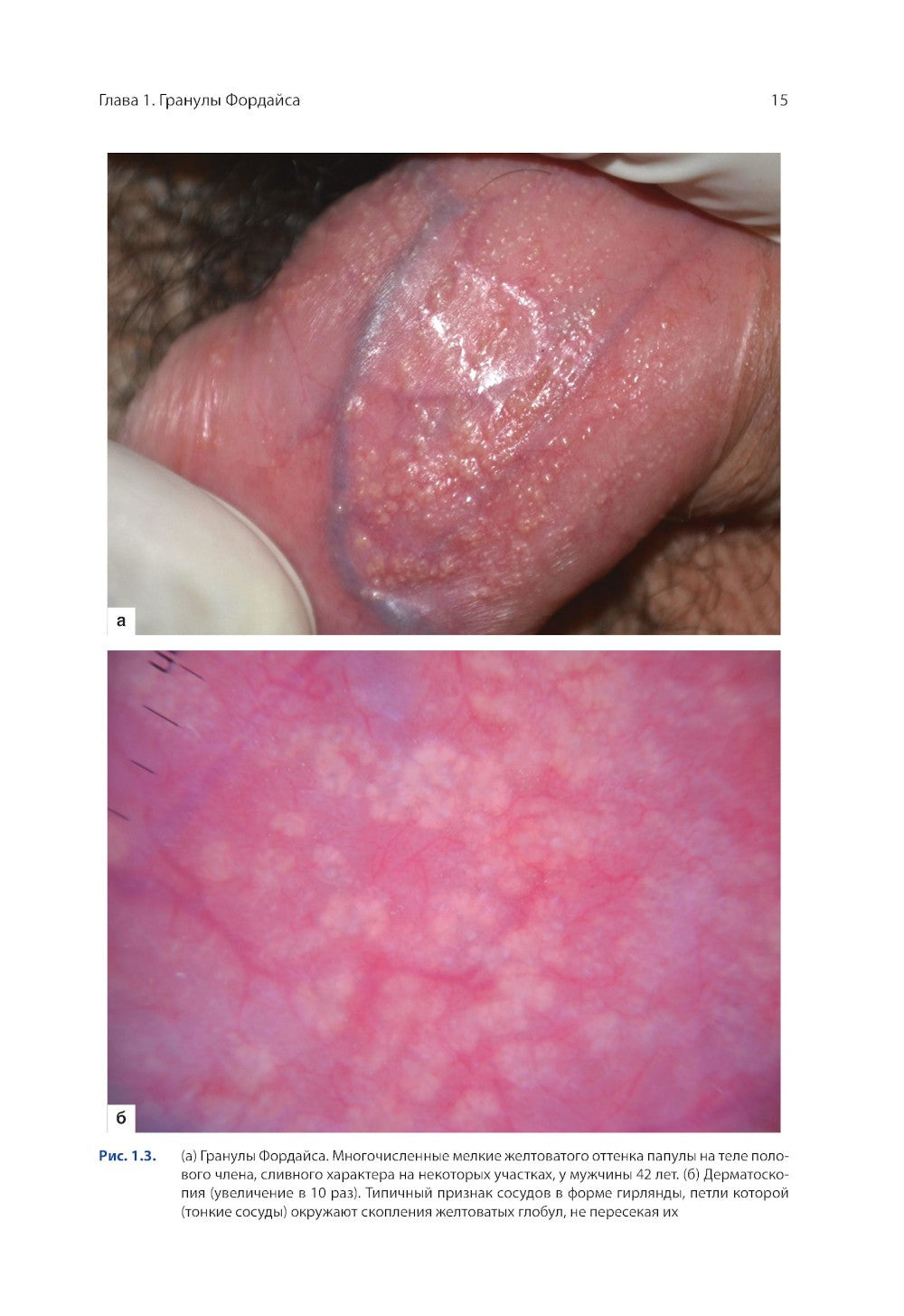 Атлас генитальной дерматоскопии