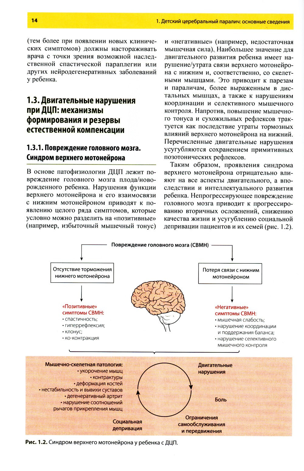 Ботулинотерапия при детском церебральном параличе. Практические советы и ульт...