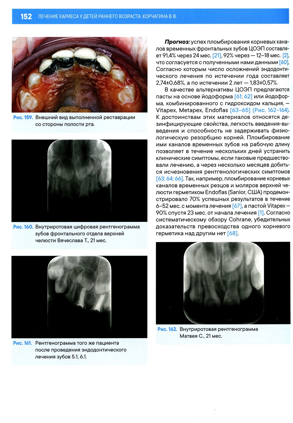 Лечение кариеса у детей раннего возраста