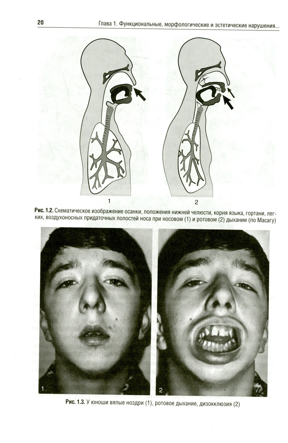 Ортодонтия. Диагностика и функциональные методы профилактики и лечения зубоче...