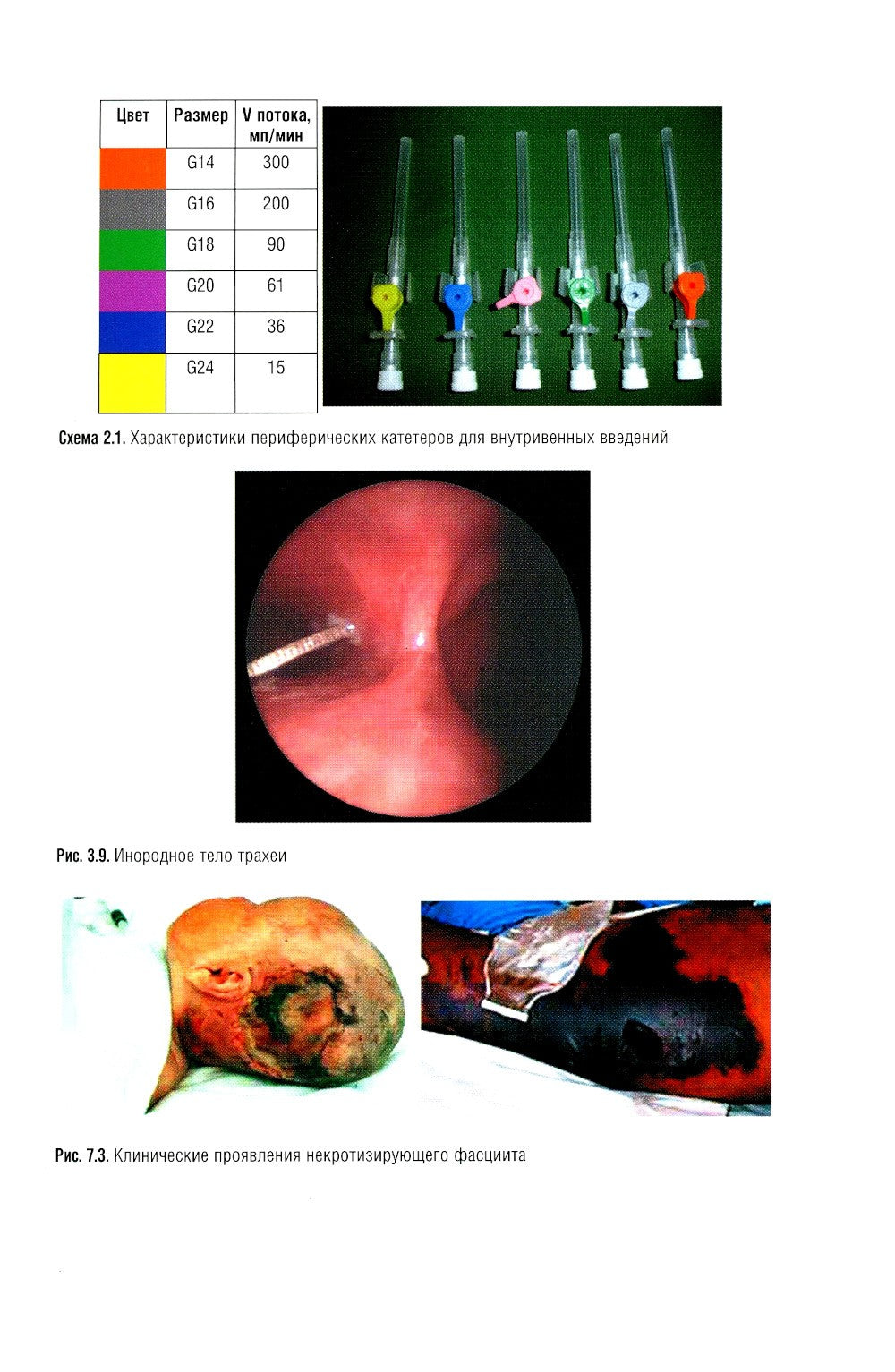 Неотложная педиатрия: национальное руководство