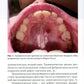 Ортодонтия и патология слизистой оболочки рта