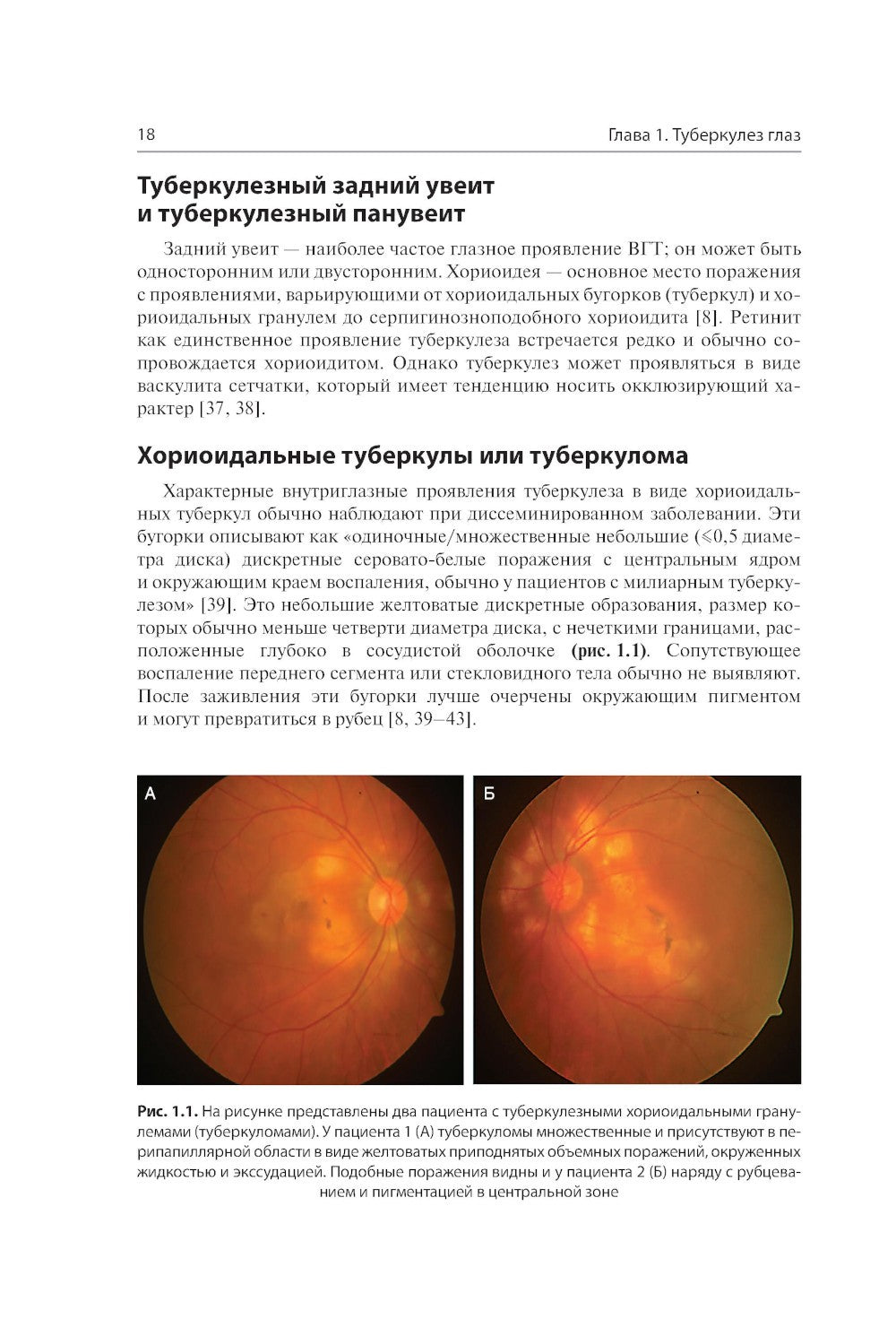 Инфекции глаз