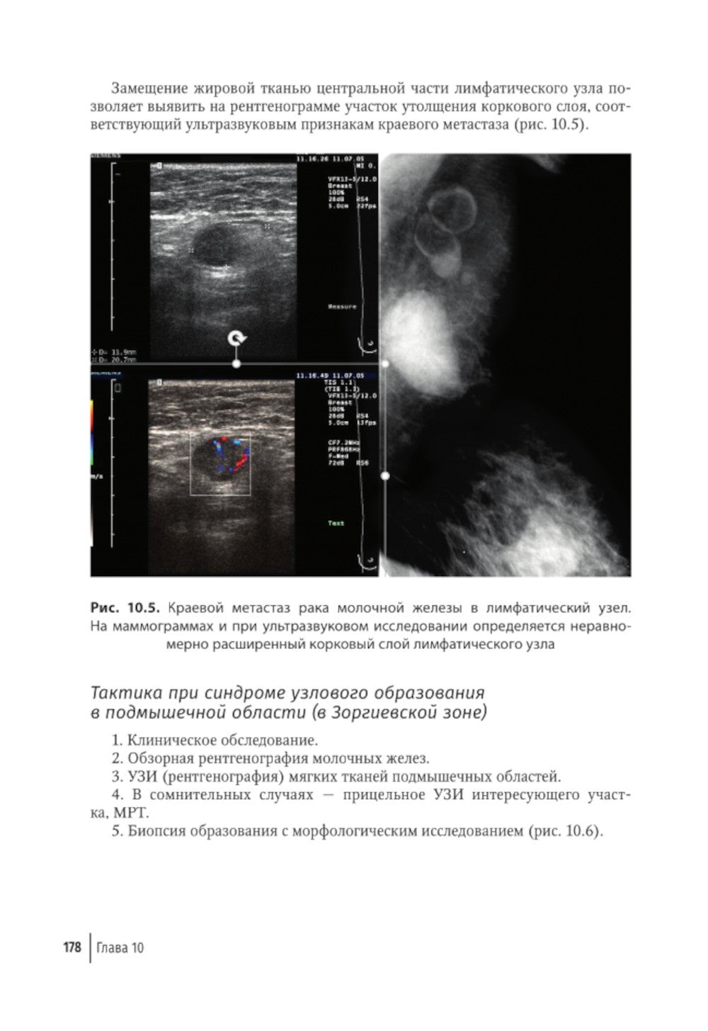 Атлас-путеводитель по медицинским изображениям молочной железы. Тестовые моду...