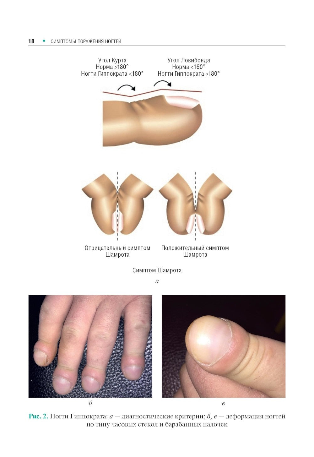 Поражения ногтей в практике врача-дерматовенеролога: руководство для врачей