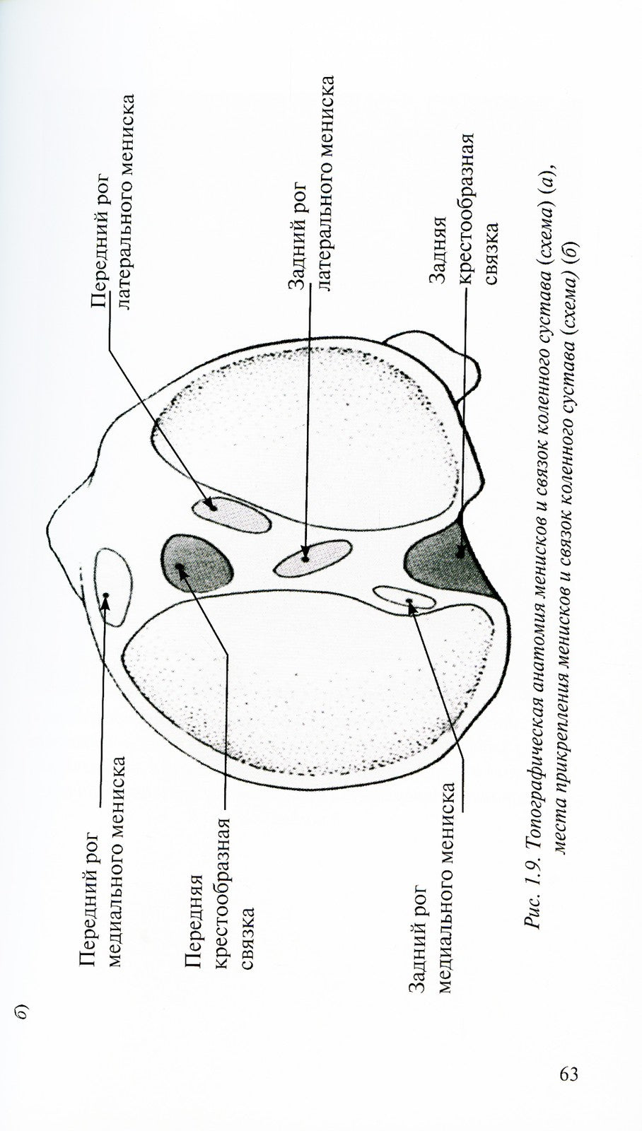 Лучевая диагностика повреждений коленного сустава (Конспект лучевого диагност...