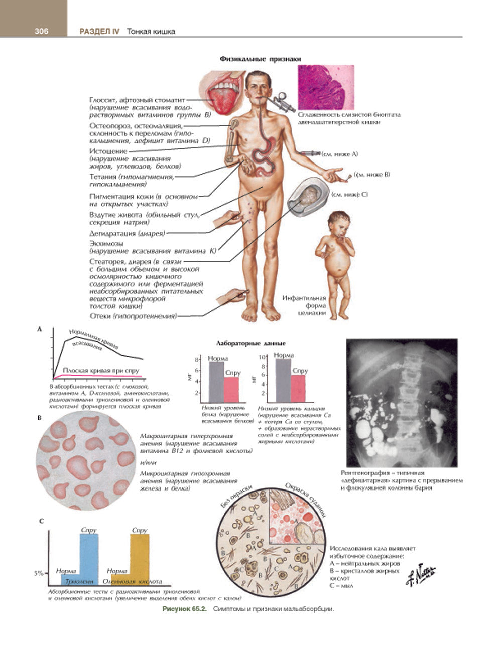 Гастроэнтерология с иллюстрациями Неттера. В 2 ч. (комплект из 2 кн.)