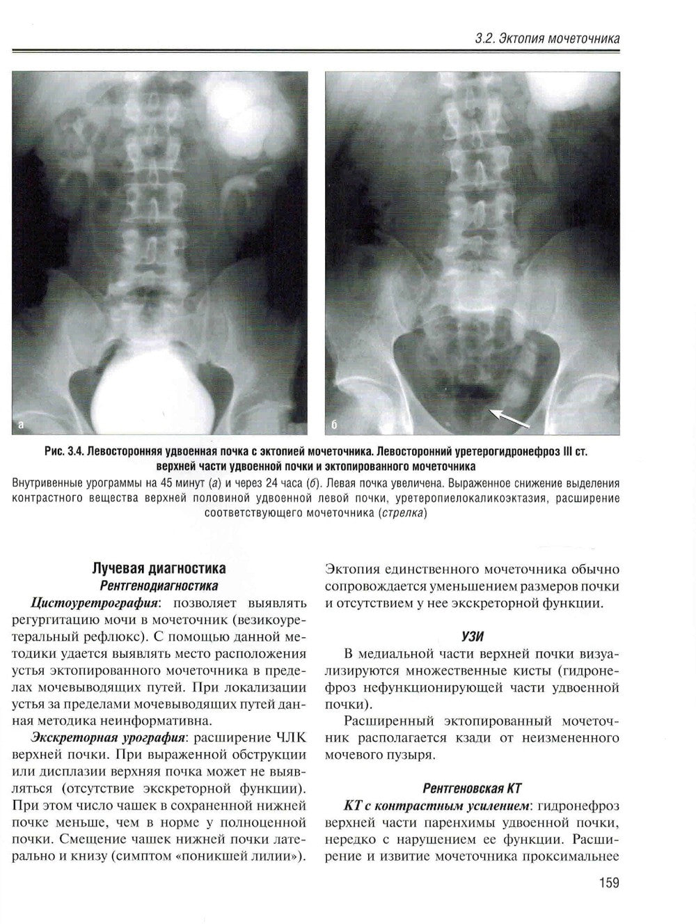 Визуализация заболеваний почек, мочеточников и мочевого пузыря: Учебное пособие