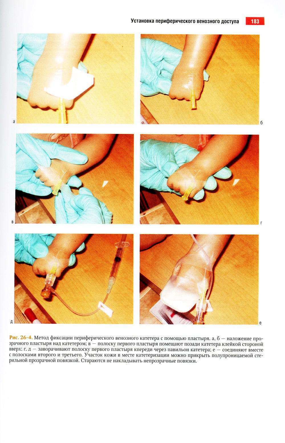 Атлас манипуляций в неонатологии