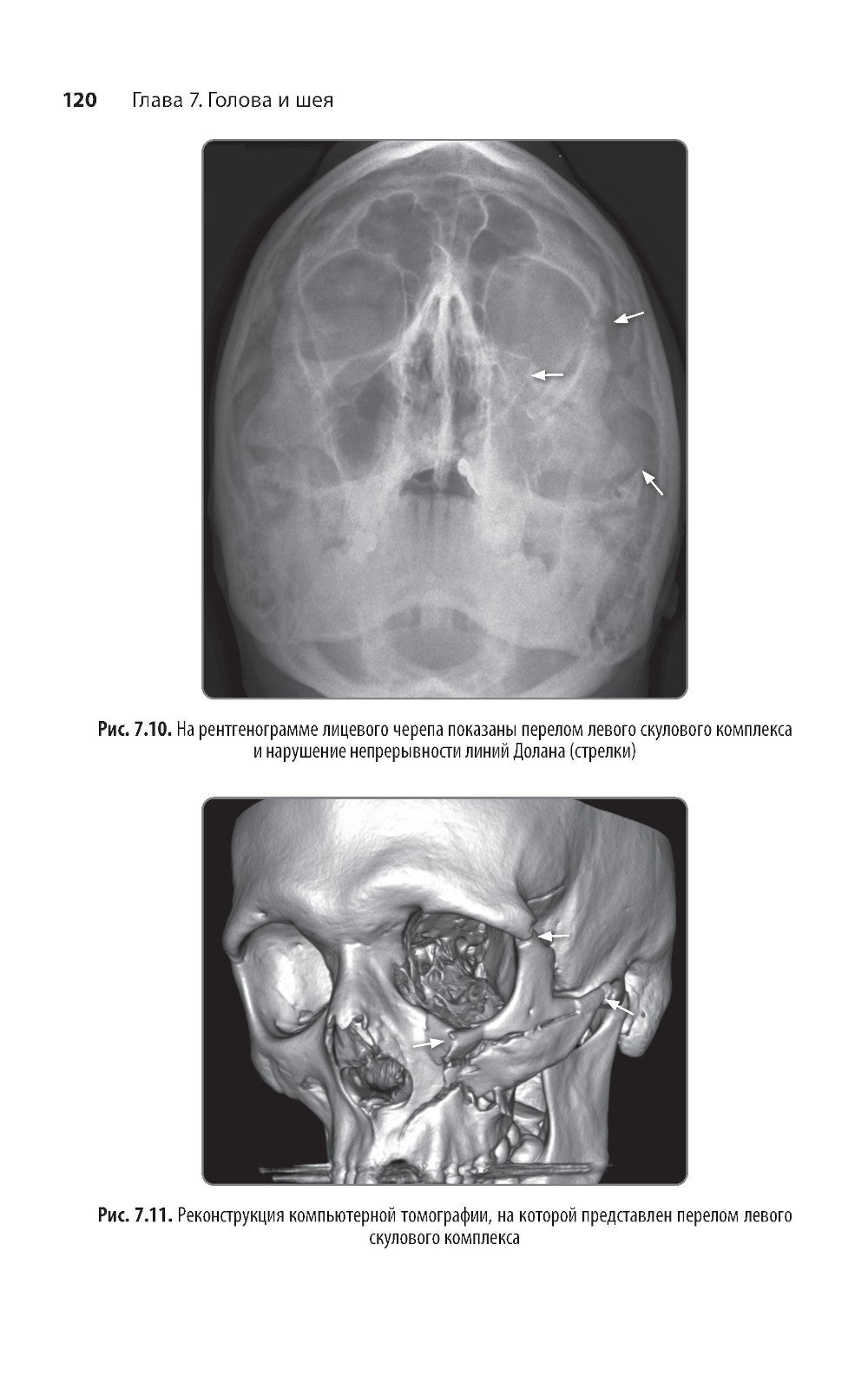 Неотложная радиология: карманный справочник