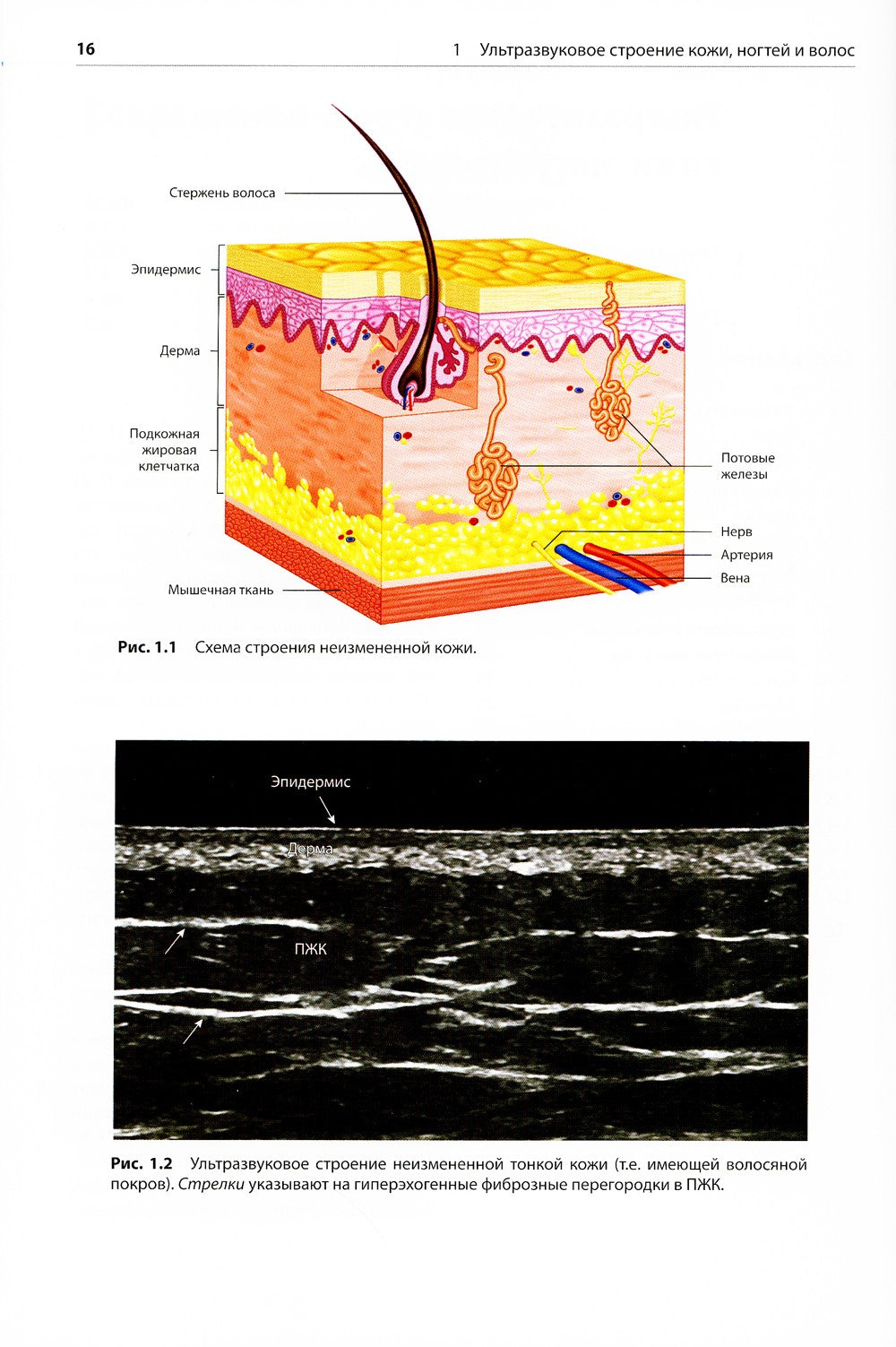 Атлас по ультразвуковому исследованию в дерматологии: мягкие ткани, кожа, при...