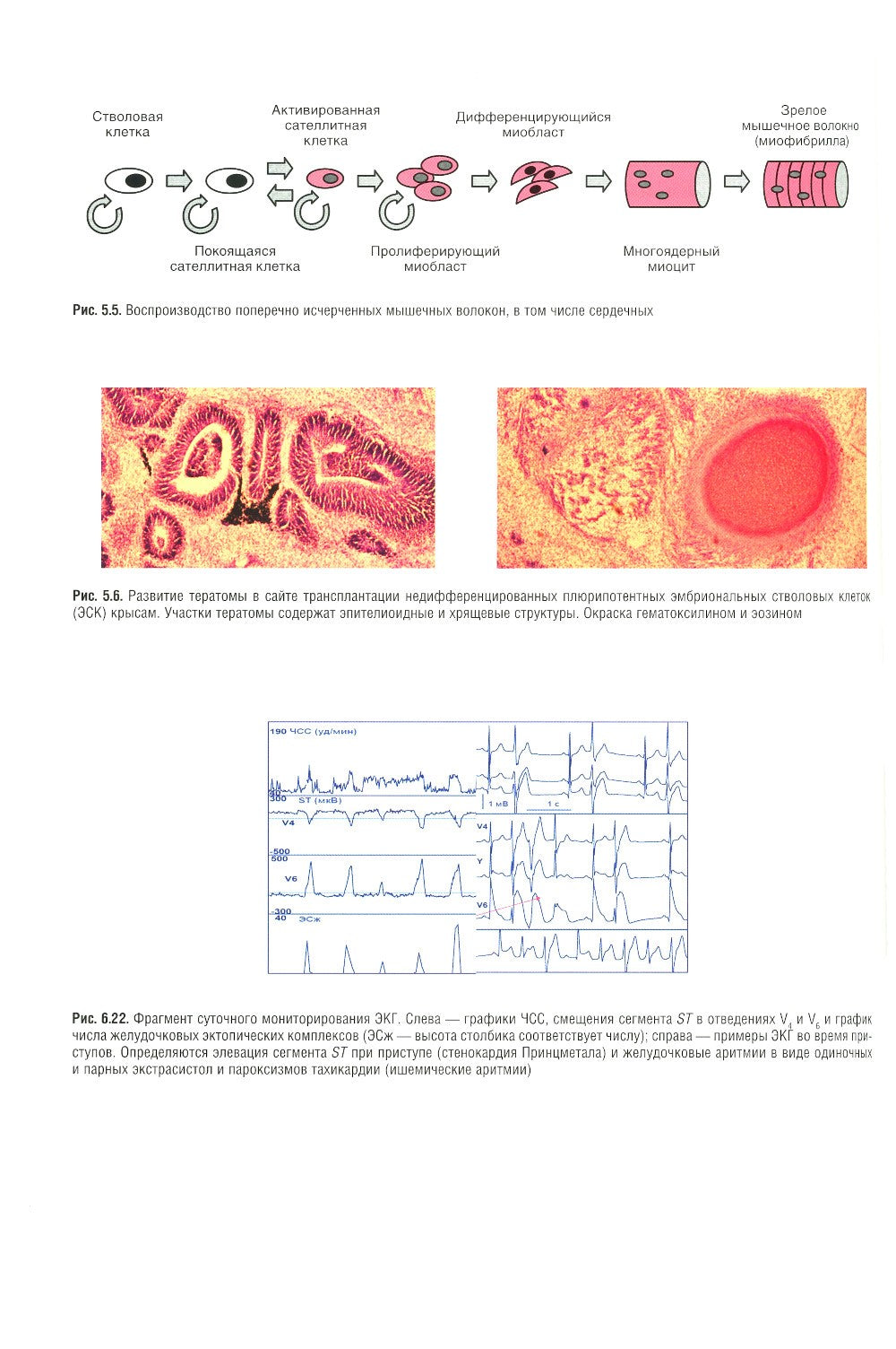 Кардиология: национальное руководство. 2-е изд., перераб. и доп