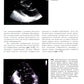 Клиническая эхокардиография: основной курс