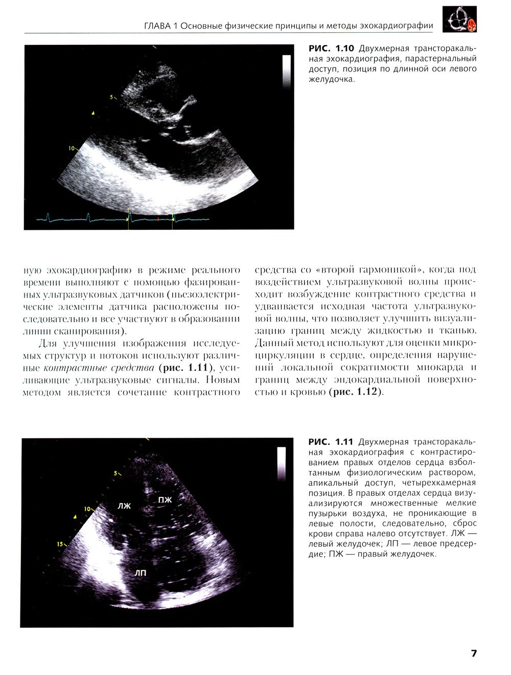 Клиническая эхокардиография: основной курс
