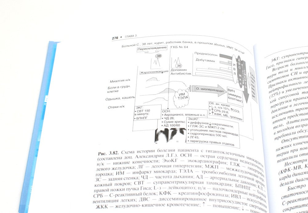 Кардиомиопатии и миокардиты. 2-е изд., перераб. и доп