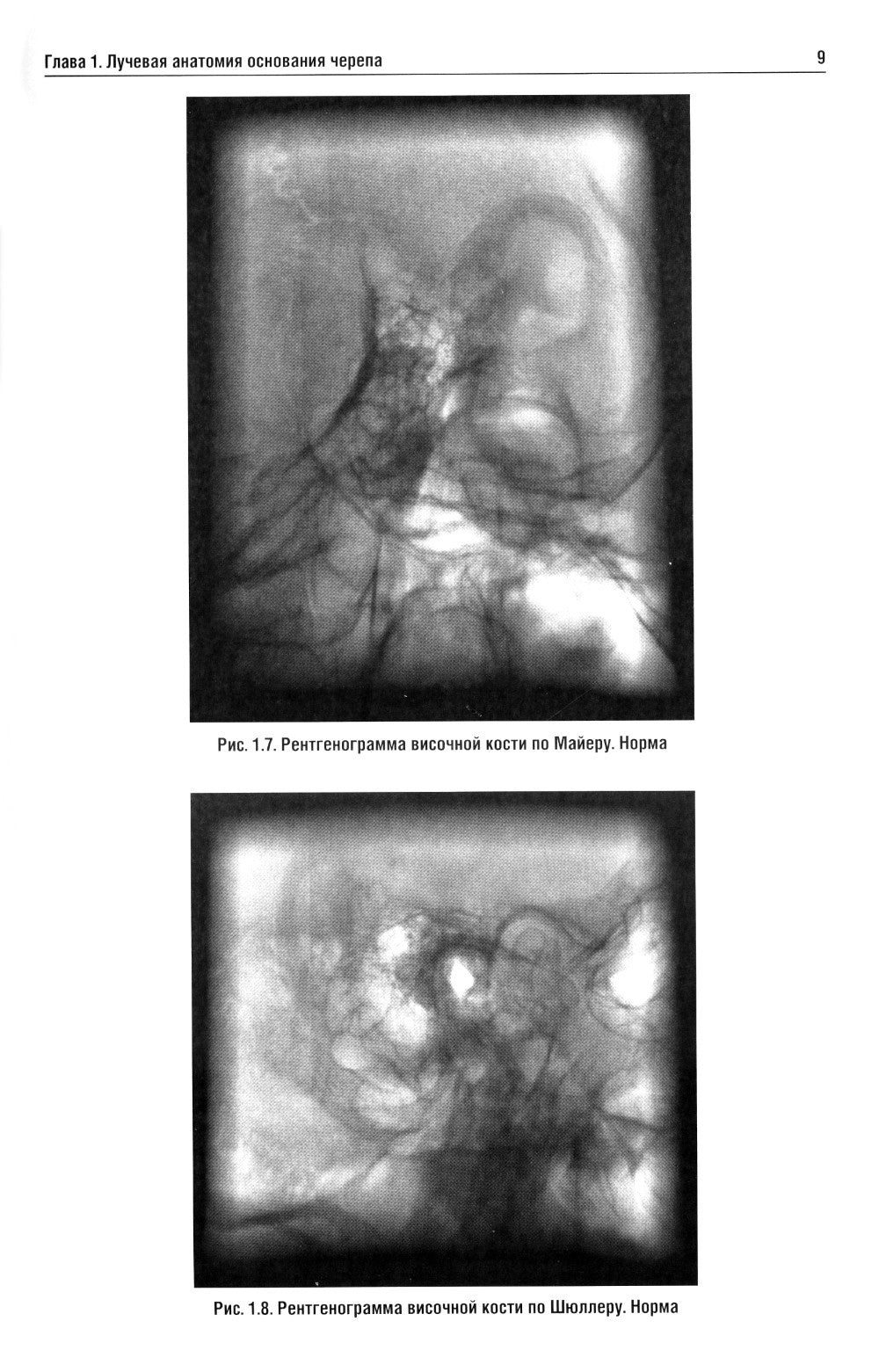 Лучевая диагностика заболеваний оснований черепа и мостмозжечкового угла: Уче...