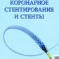 Коронарное стентирование и стенты