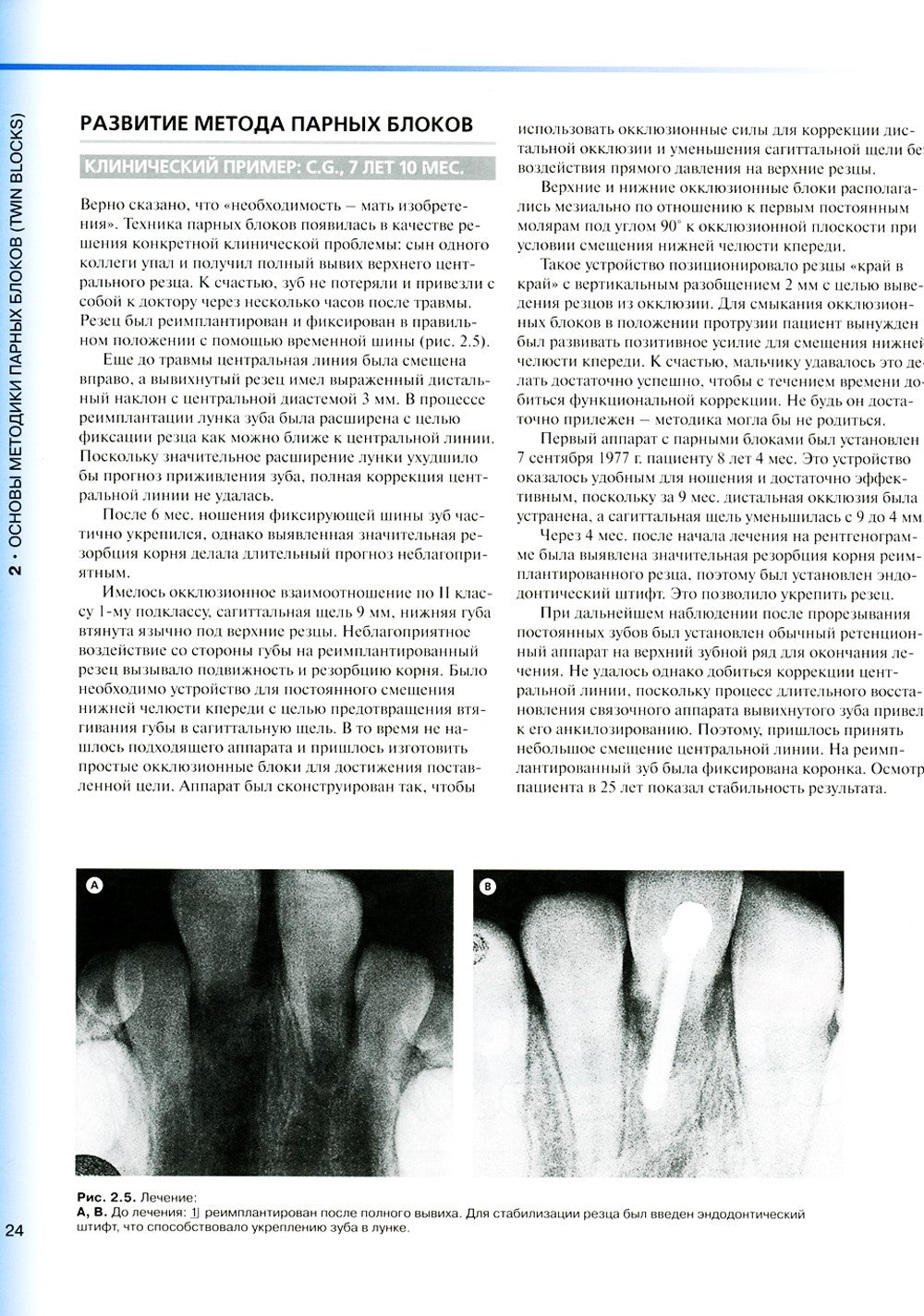 Ортодонтическое лечение парными блоками. 3-е изд