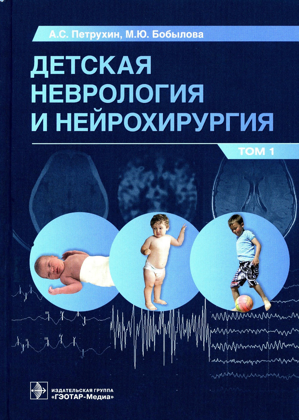 Детская неврология и нейрохирургия: Учебник. В 2 т. Т. 1