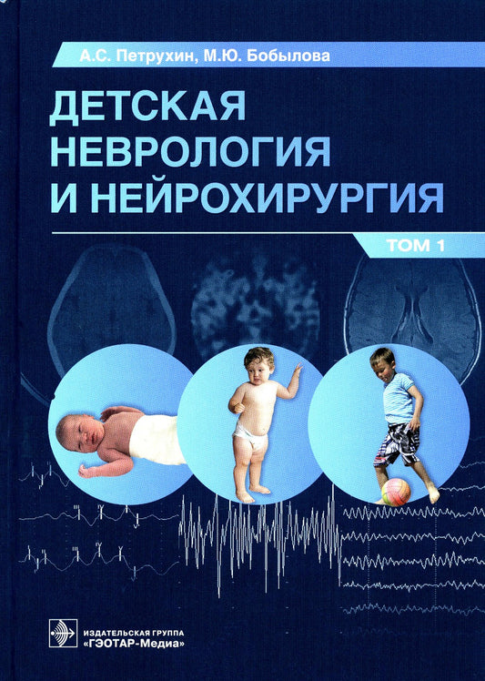 Детская неврология и нейрохирургия: Учебник. В 2 т. Т. 1