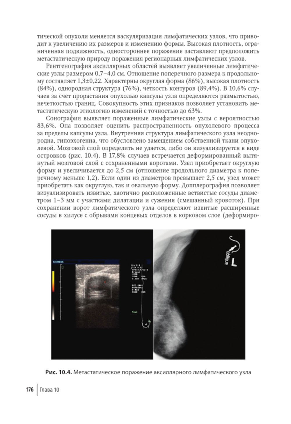 Атлас-путеводитель по медицинским изображениям молочной железы. Тестовые моду...