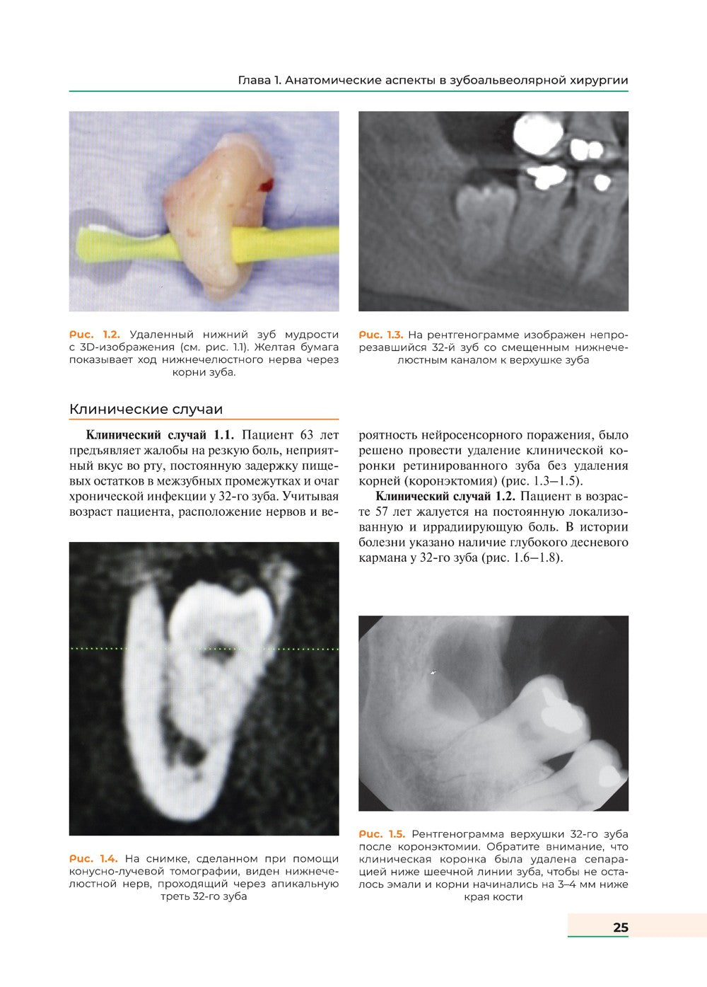 Оперативная хирургия полости рта и челюстно-лицевой области. Атлас