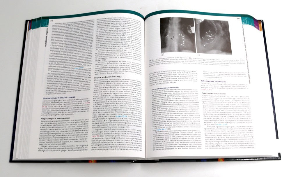 Болезни сердца по Браунвальду. Руководство по сердечно-сосудистой медицине. В...