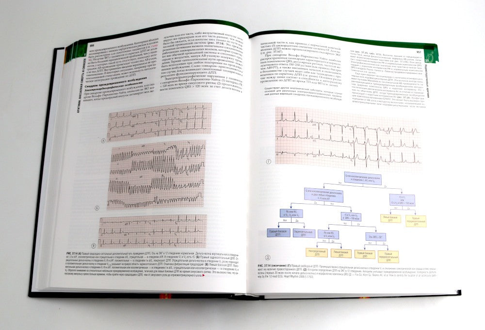 Болезни сердца по Браунвальду. Руководство по сердечно-сосудистой медицине. В...