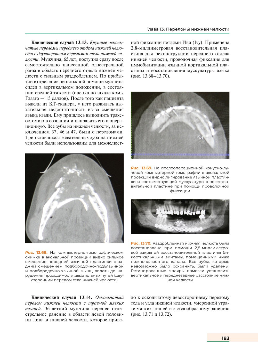Оперативная хирургия полости рта и челюстно-лицевой области. Атлас