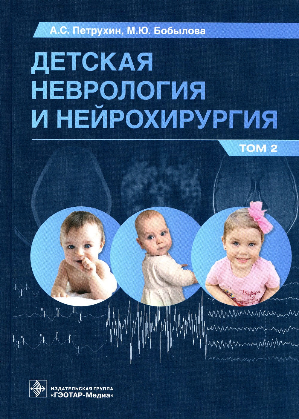 Детская неврология и нейрохирургия: Учебник. В 2 т. Т. 2