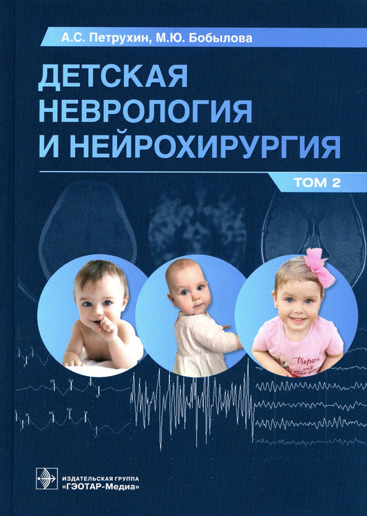 Детская неврология и нейрохирургия: Учебник. В 2 т. Т. 2