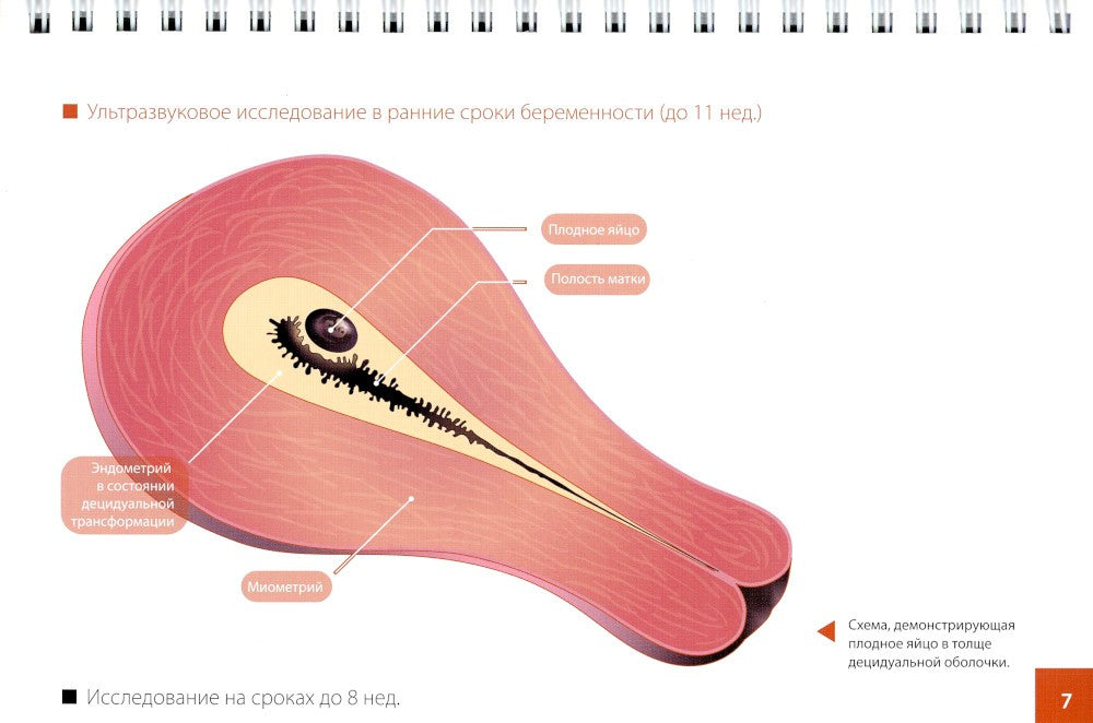 Атлас по ультразвуковой диагностике в акушерстве (эхограммы с комментариями):...